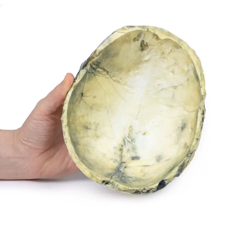 3D Printed Tertiary Syphilis